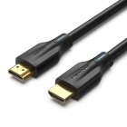 Vention AANBG HDMI kábel 1,5m - Fekete